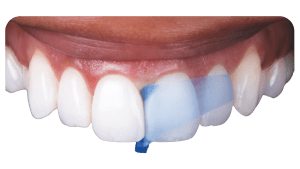 Teeth-banner-High-resolution scaled